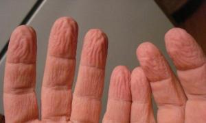 Wrinkles on the fingertips - recipes for the most effective homemade masks Why do fingers swell in water