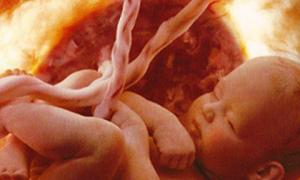 भ्रूण का फोटो, पेट का फोटो, अल्ट्रासाउंड और 31 सप्ताह में बच्चे के विकास के बारे में वीडियो, गर्भवती महिला का वजन