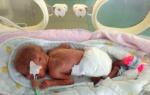 Premature babies - degrees and signs of prematurity in a newborn baby, characteristics of the body and behavior