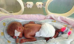 Premature babies - degrees and signs of prematurity in a newborn baby, characteristics of the body and behavior