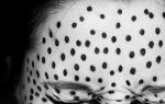 Hogyan lehet fekete pontokat szorítani az orron: a módszerek hatékonyságának áttekintése és ellenőrzése