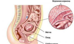 Gimdos placentos kraujotakos sutrikimas nėštumo metu
