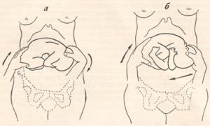 Rrotullimi obstetrik i fetusit - një mundësi për të shmangur seksionin cezarian